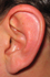 left Ear